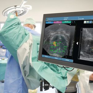 Warsztaty Biopsja fuzyjna