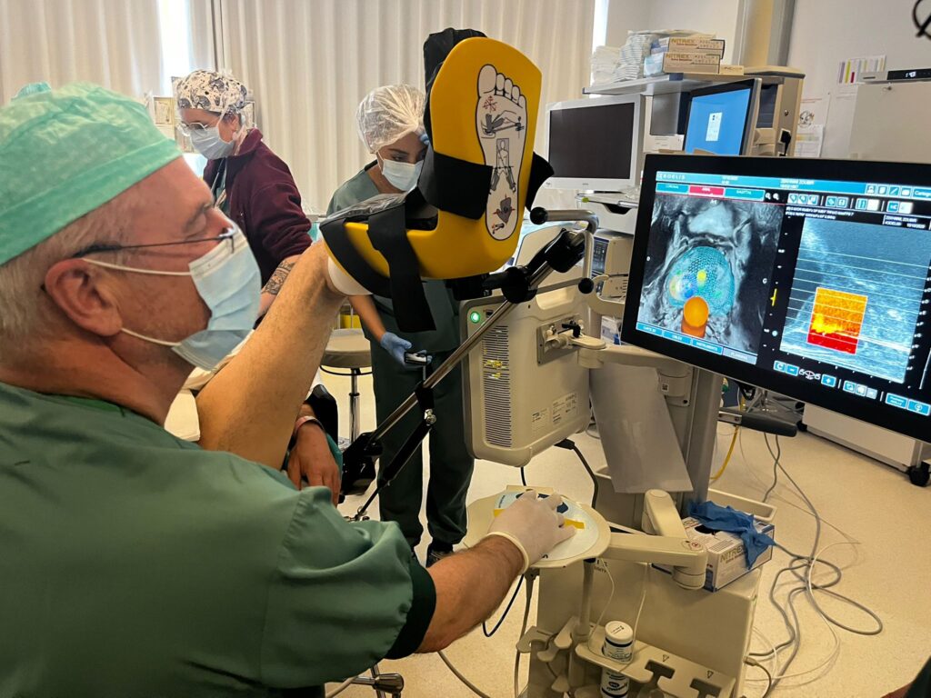 Fokalna ablacja guzów stercza – czas na Polskę